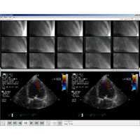 DEKOM DICOM Viewer DICOM Format