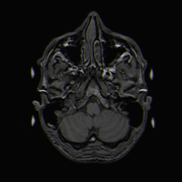 MRI Magnetresonanztomographie Schweiz