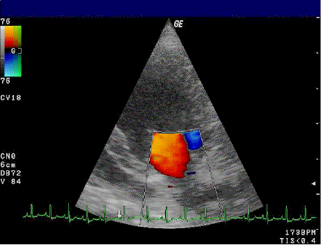 Sonografie Schweiz